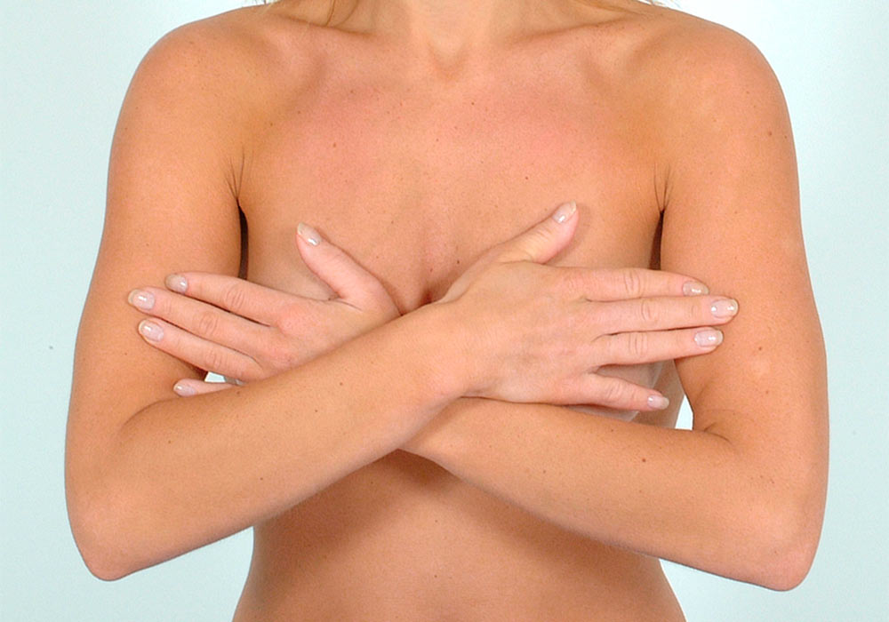breast implant illness / breast implant disease